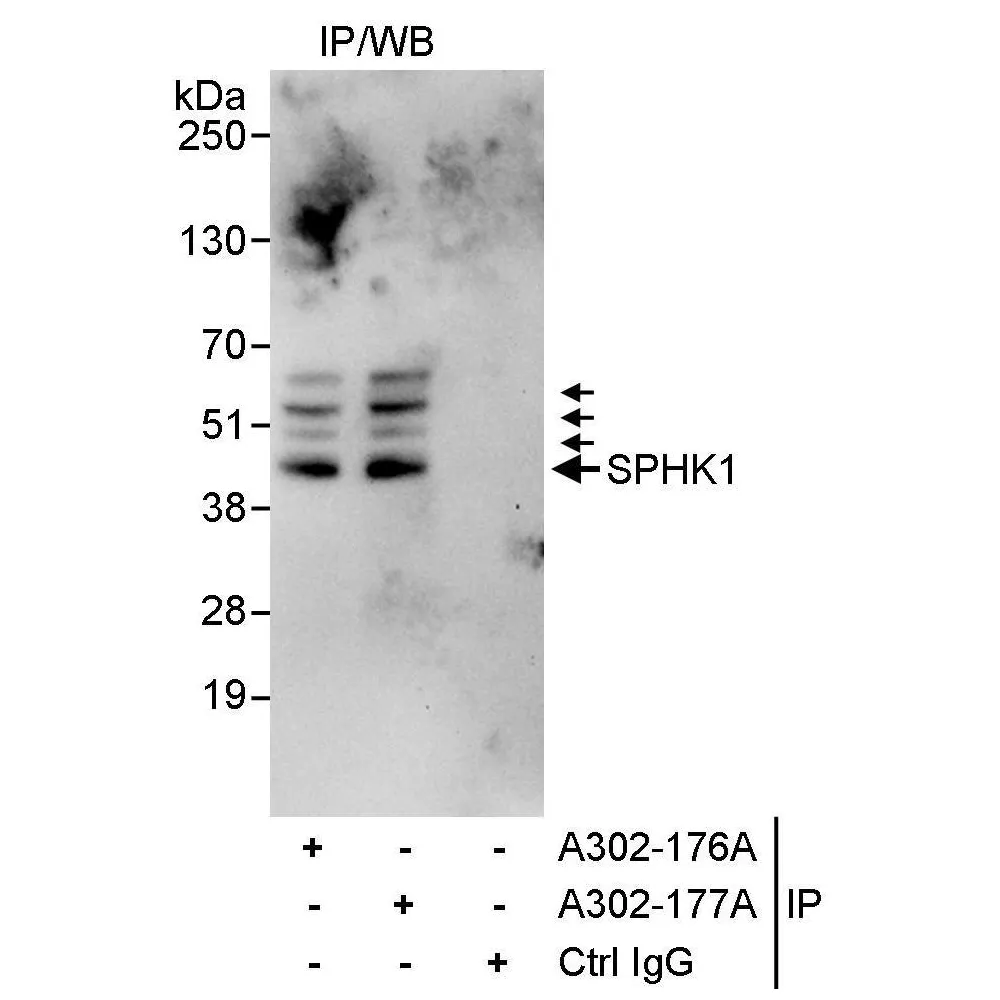 Rabbit anti-SPHK1 Antibody, Affinity Purified