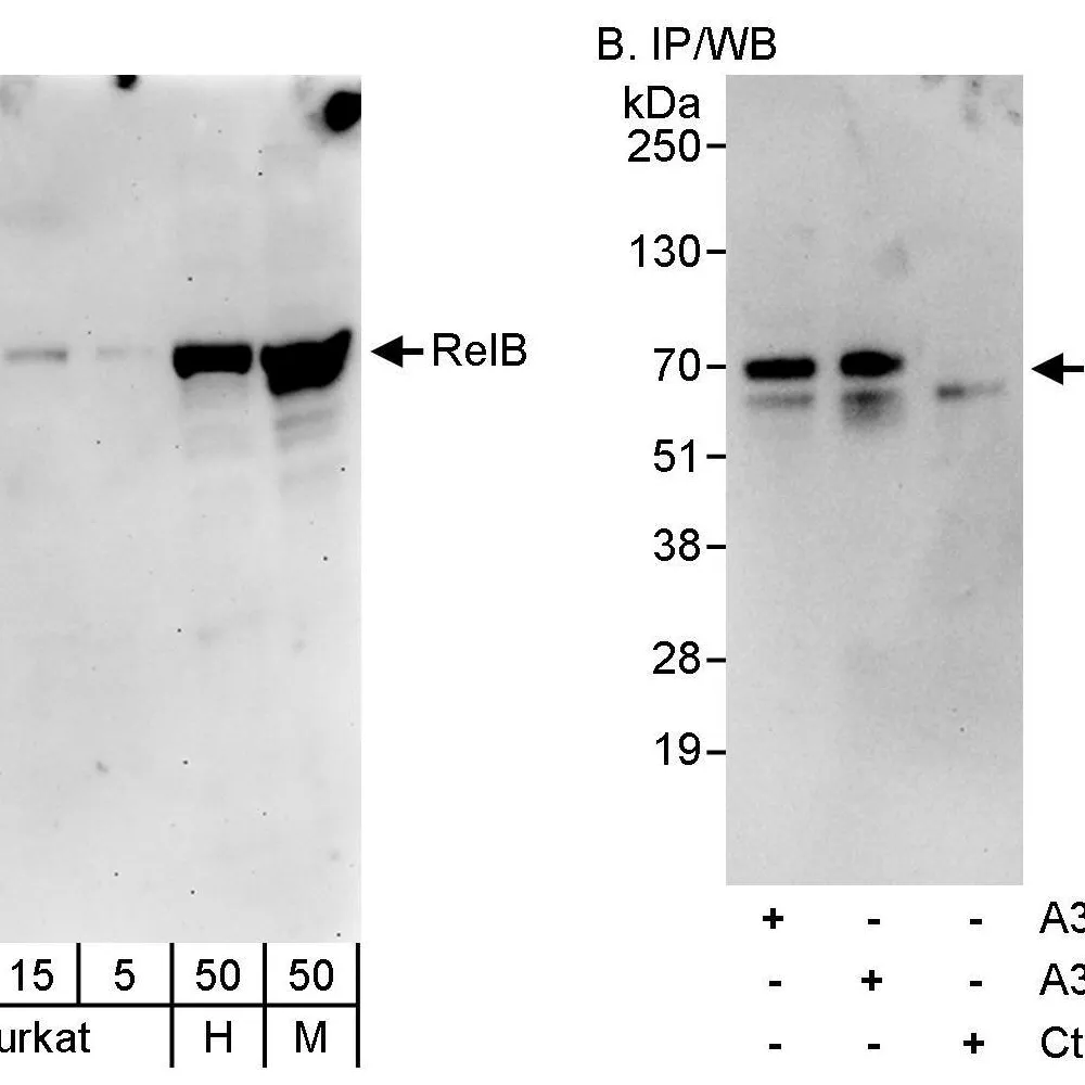 Rabbit anti-RelB Antibody, Affinity Purified