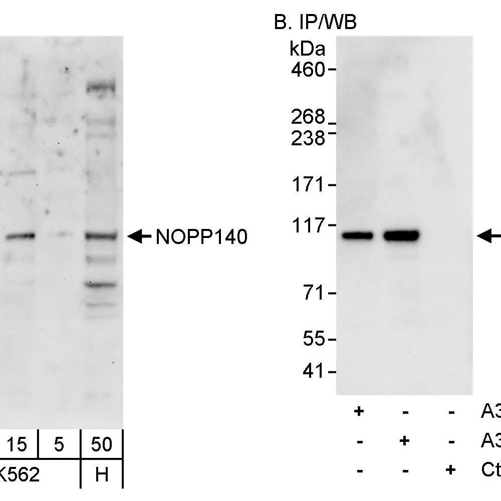 Rabbit anti-NOPP140 Antibody, Affinity Purified