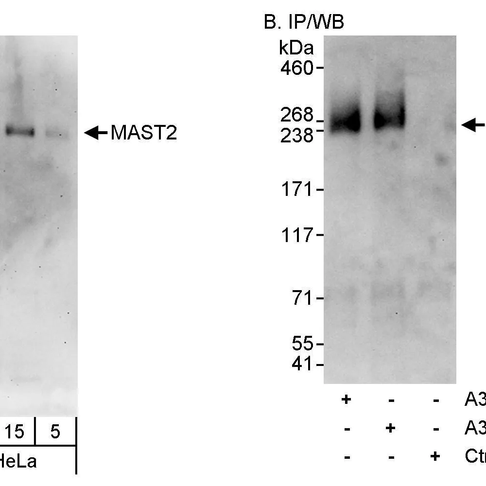 Rabbit anti-MAST2 Antibody, Affinity Purified