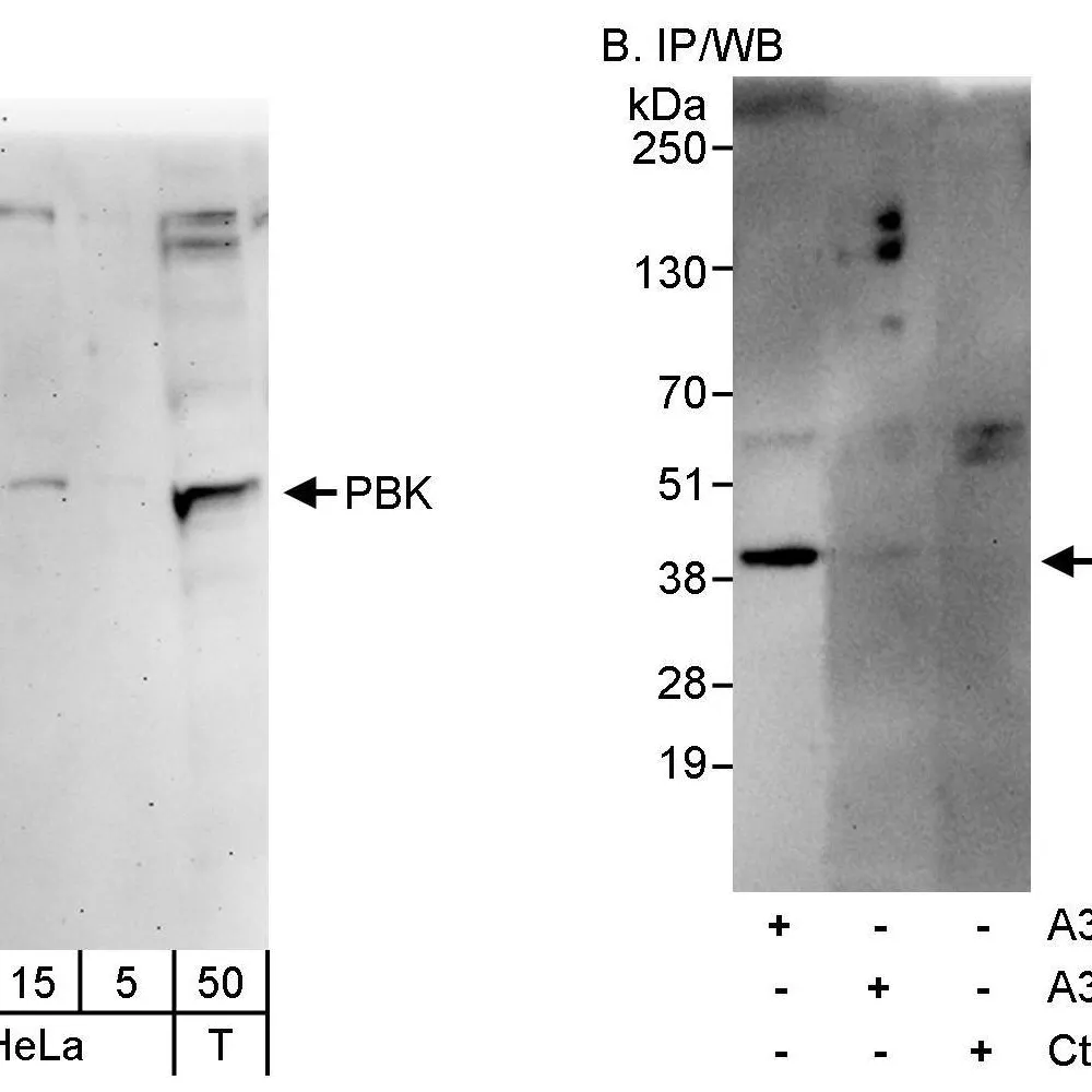 Rabbit anti-PBK Antibody, Affinity Purified
