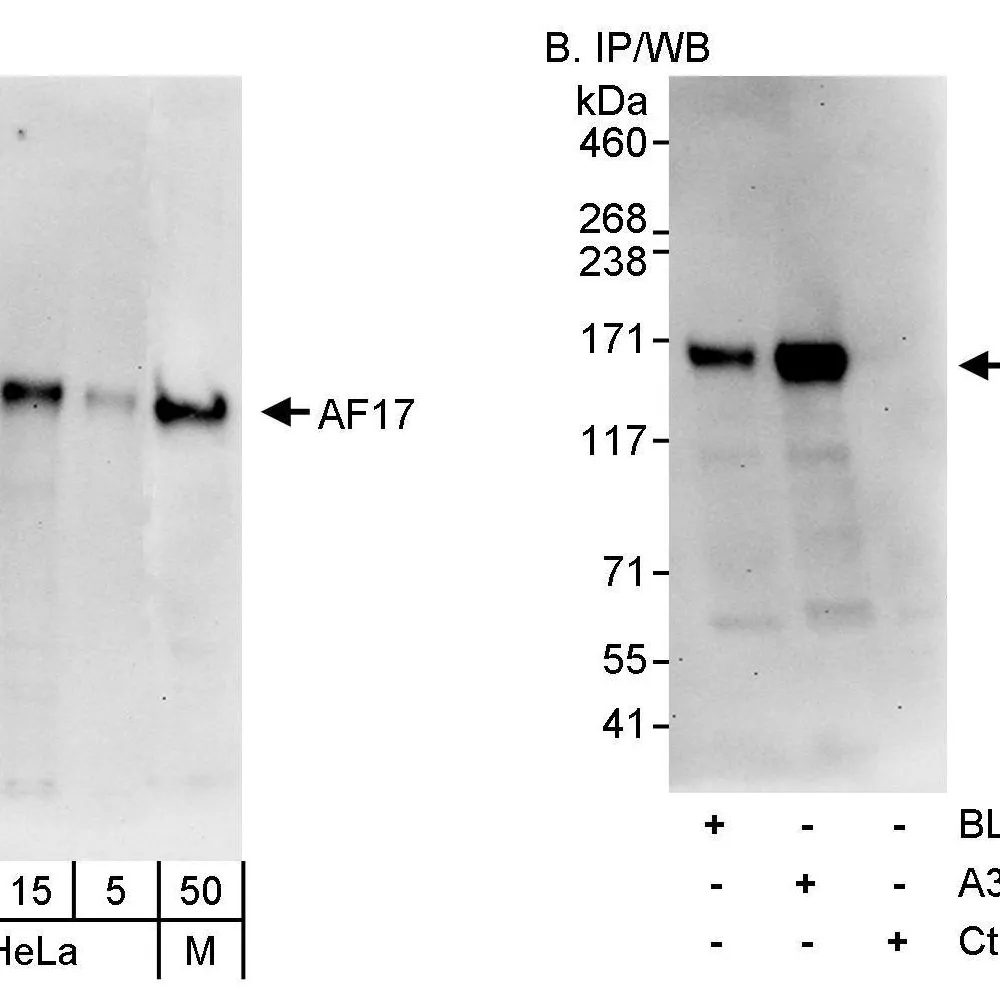 Rabbit anti-AF17 Antibody, Affinity Purified