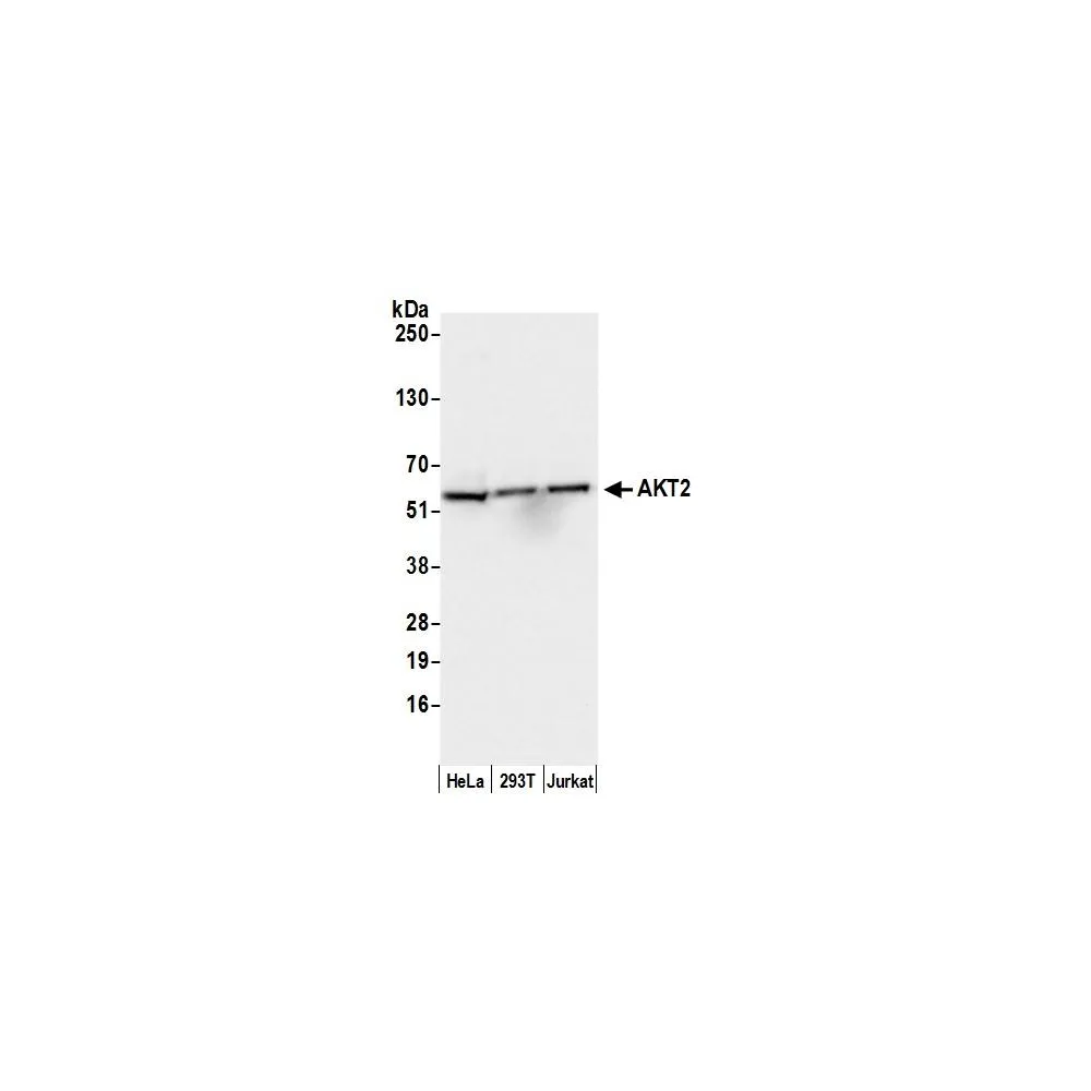 Rabbit anti-AKT2 Antibody, Affinity Purified