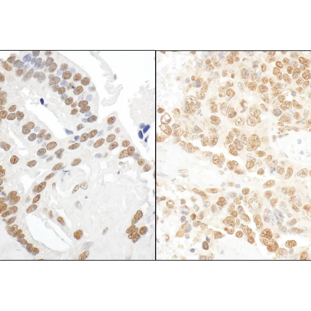 Rabbit anti-DDX27 Antibody, Affinity Purified