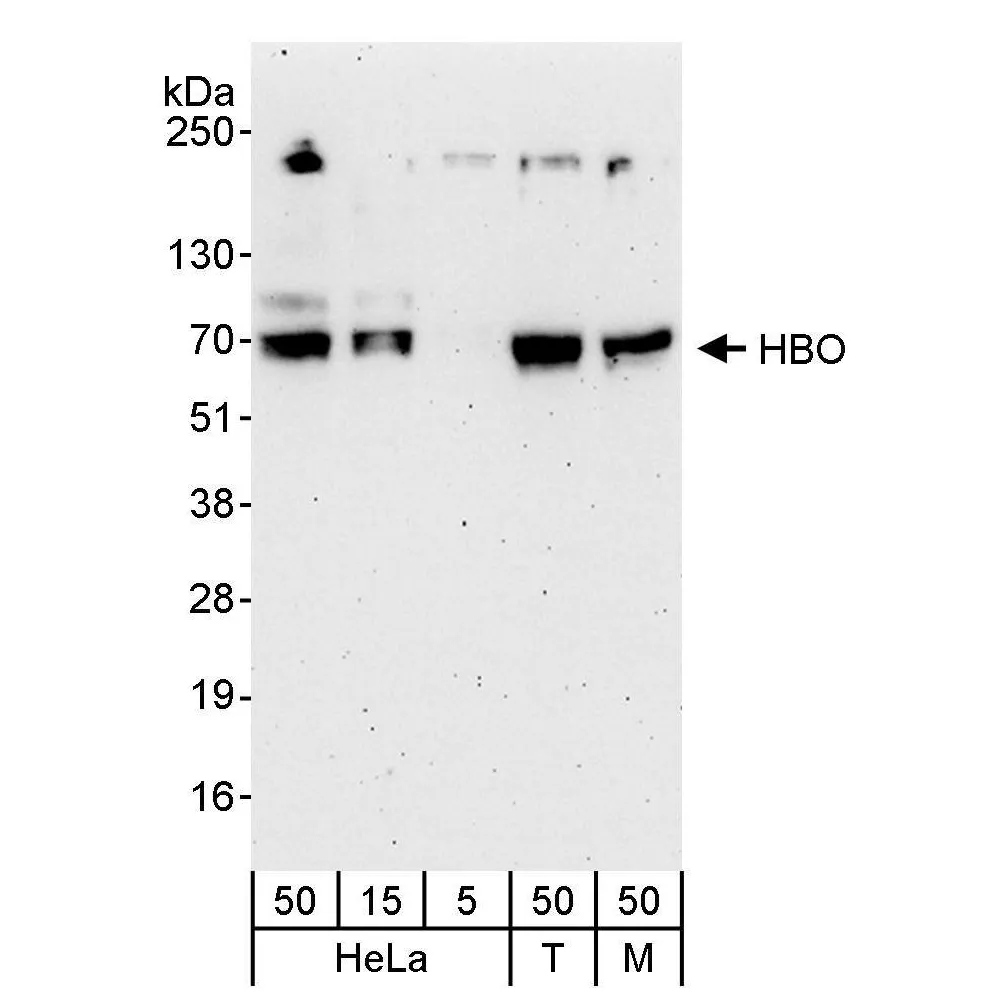 Rabbit anti-HBO Antibody, Affinity Purified