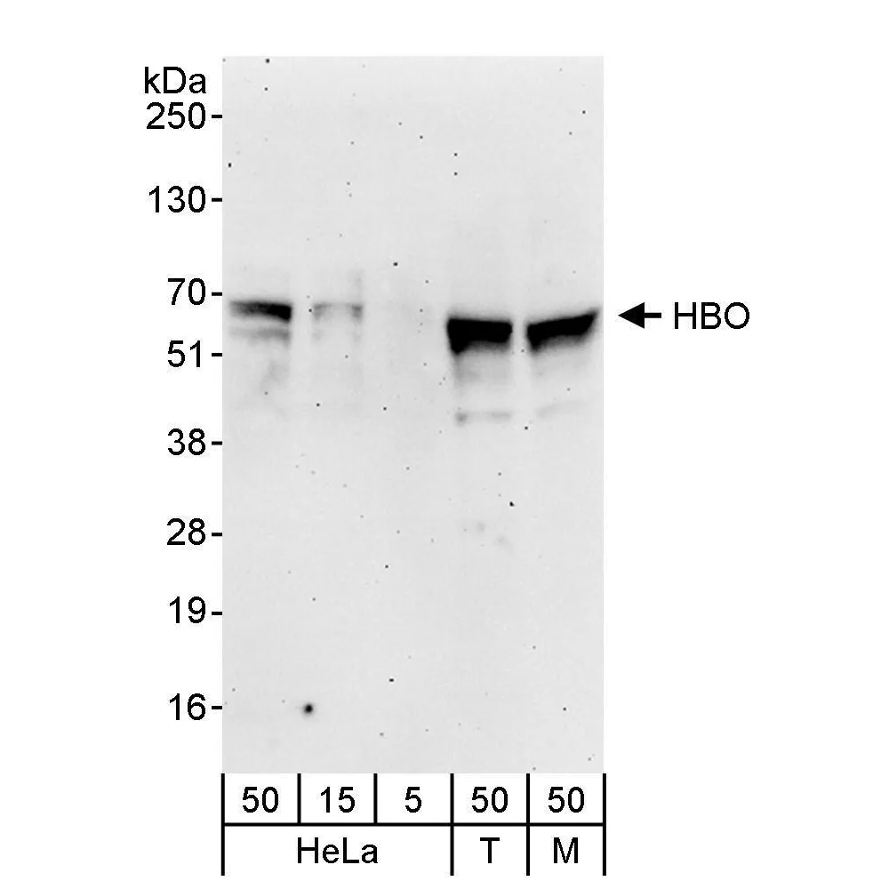 Rabbit anti-HBO Antibody, Affinity Purified