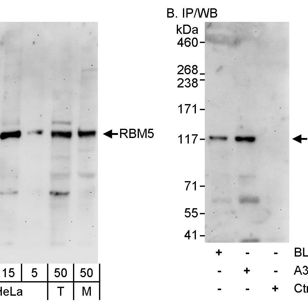 Rabbit anti-RBM5 Antibody, Affinity Purified