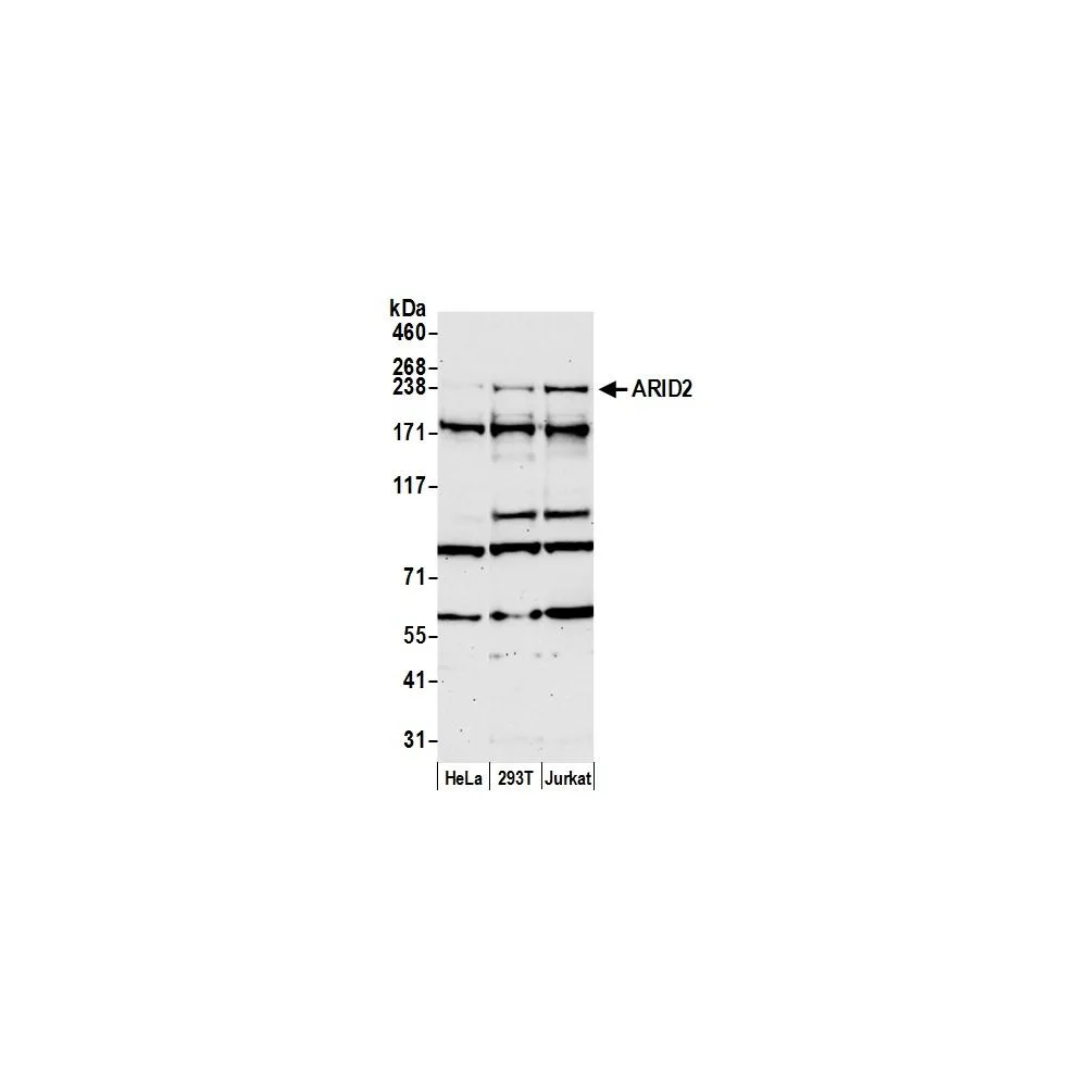 Rabbit anti-ARID2 Antibody, Affinity Purified
