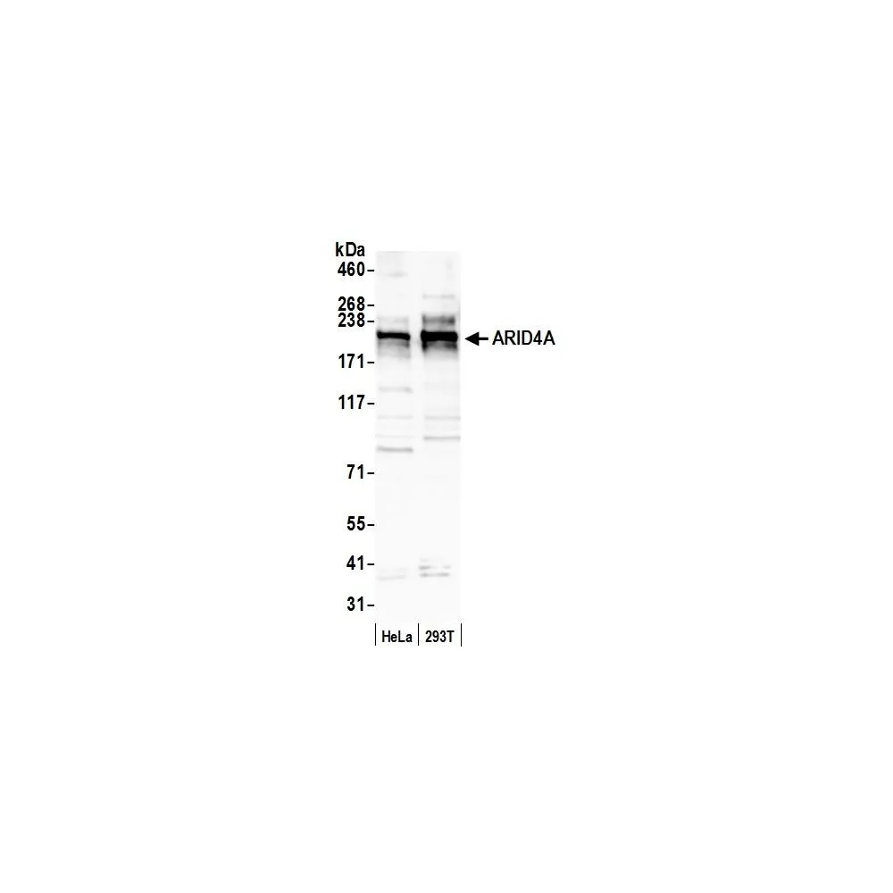 Rabbit anti-ARID4A Antibody, Affinity Purified