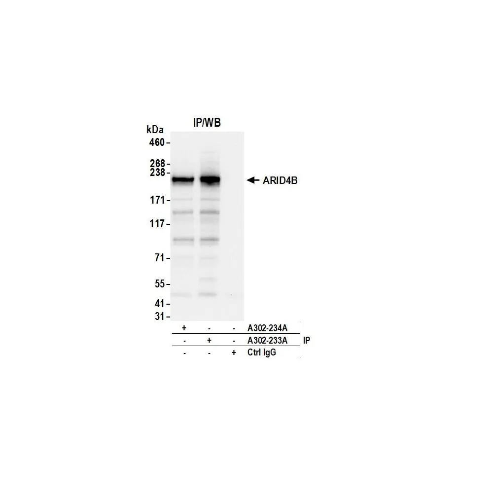 Rabbit anti-ARID4B Antibody, Affinity Purified