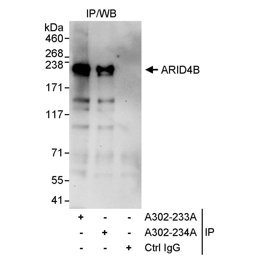 Rabbit anti-ARID4B Antibody, Affinity Purified