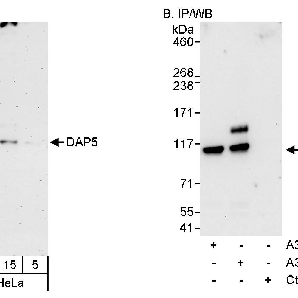 Rabbit anti-DAP5 Antibody, Affinity Purified