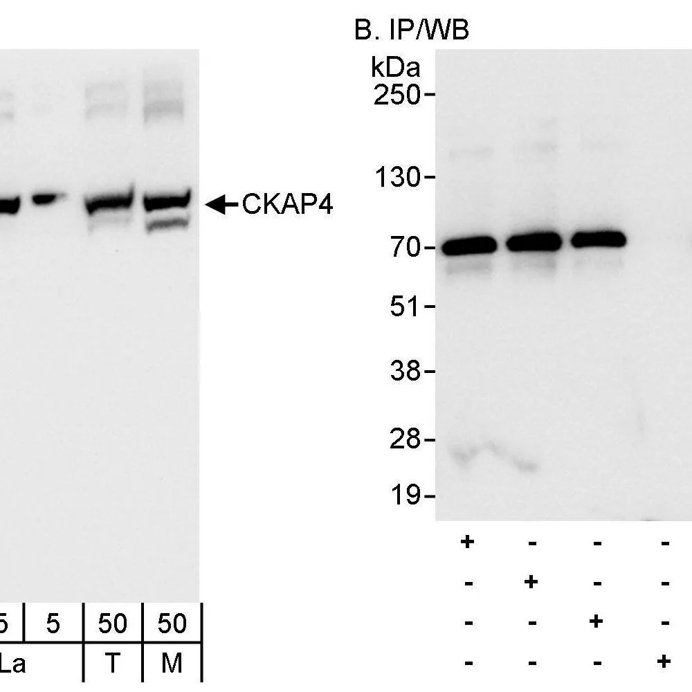 Rabbit anti-CKAP4 Antibody, Affinity Purified