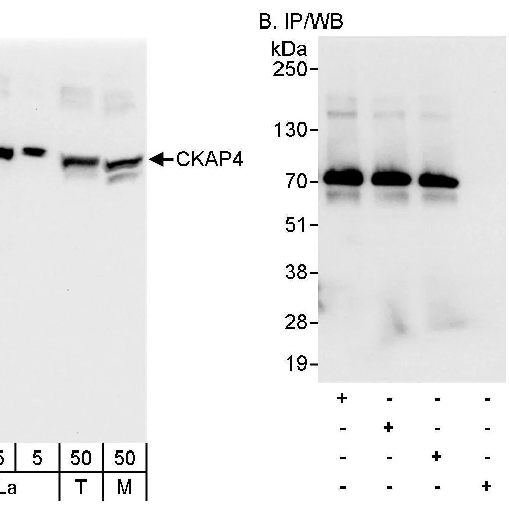 Rabbit anti-CKAP4 Antibody, Affinity Purified