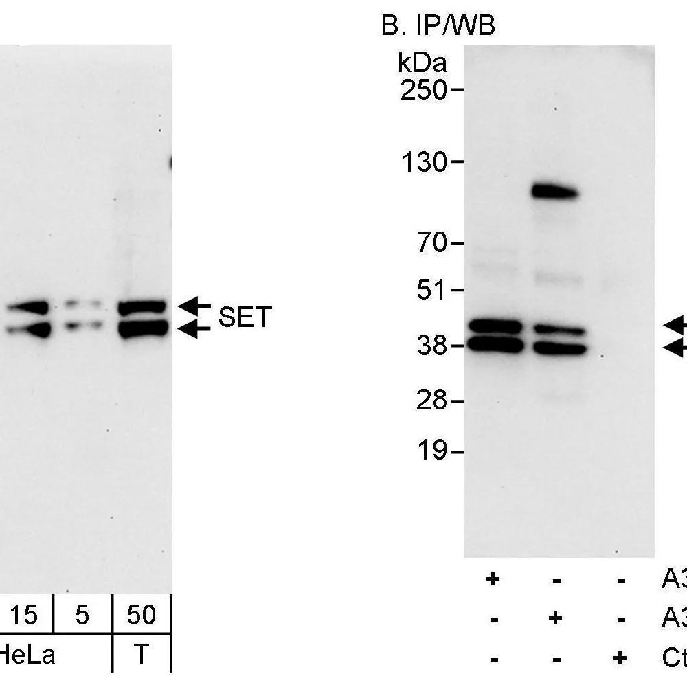 Rabbit anti-SET Antibody, Affinity Purified