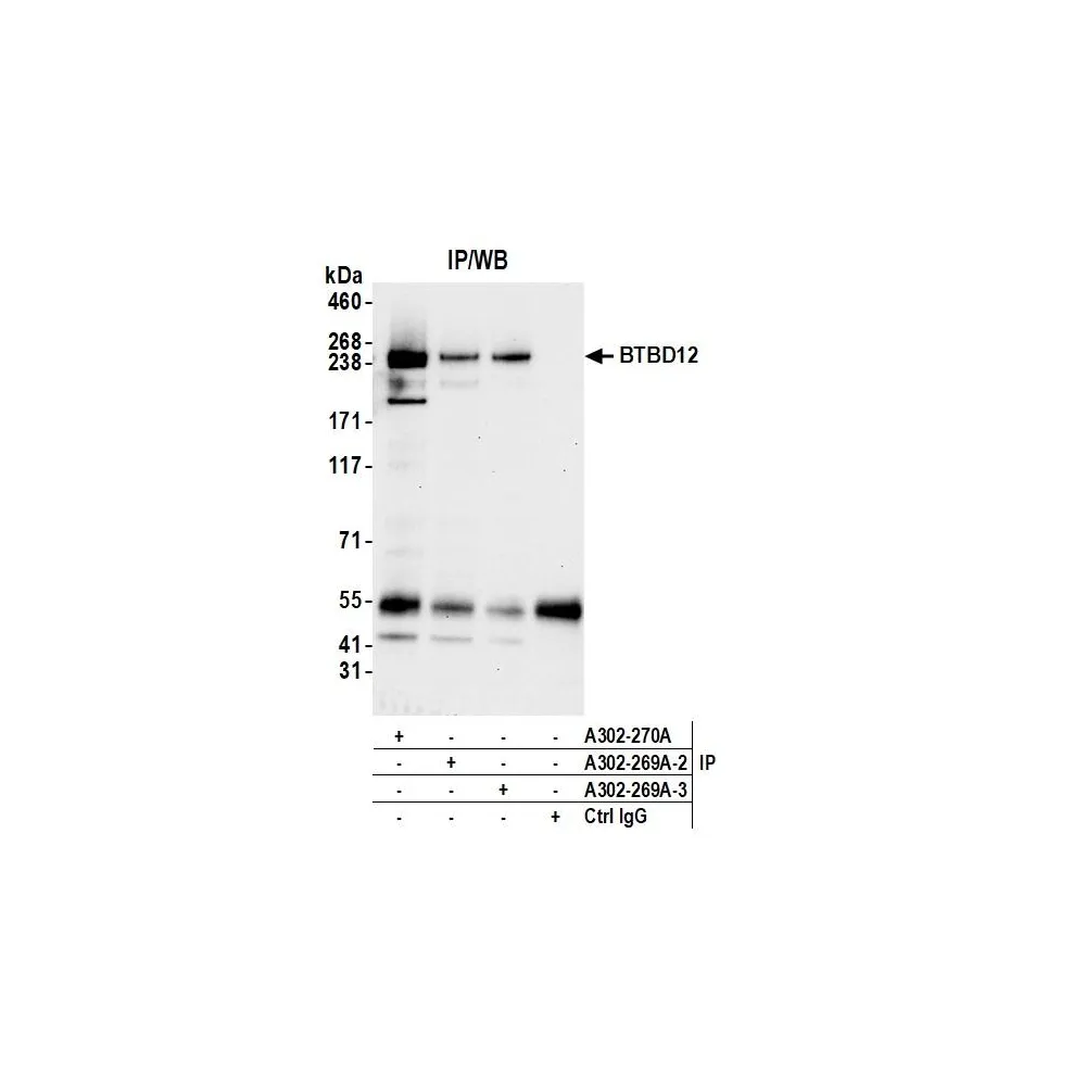 Rabbit anti-BTBD12 Antibody, Affinity Purified
