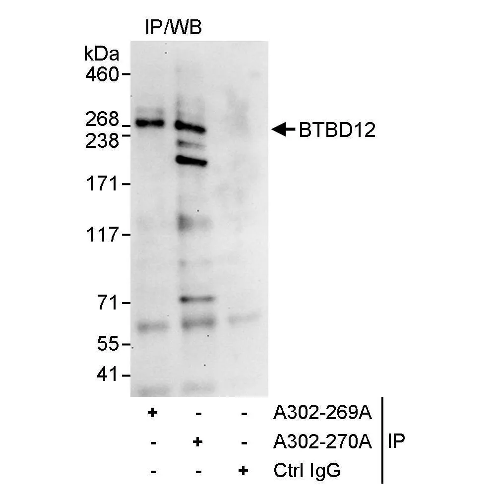 Rabbit anti-BTBD12 Antibody, Affinity Purified