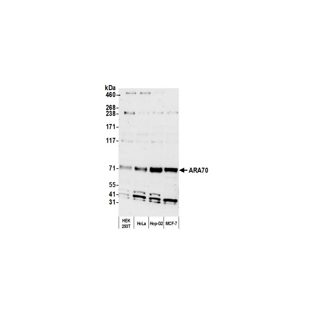 Rabbit anti-ARA70 Antibody, Affinity Purified
