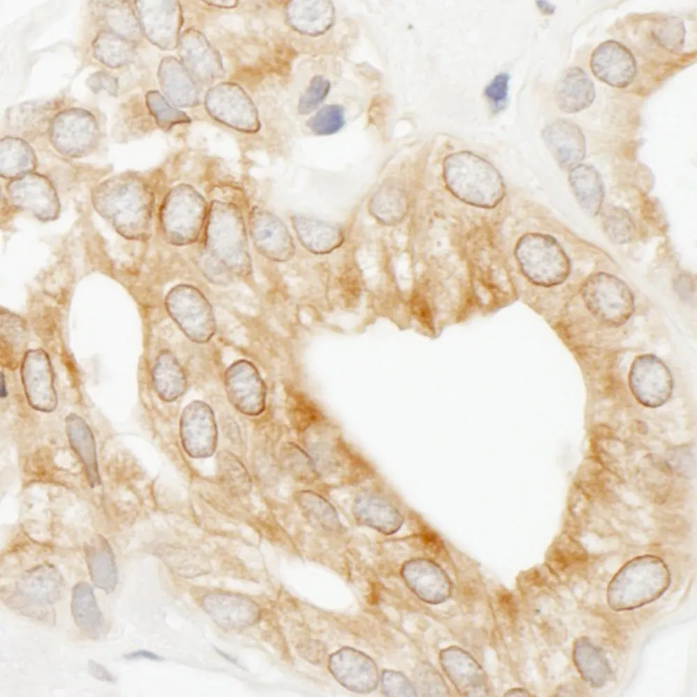 Rabbit anti-p600 Antibody, Affinity Purified