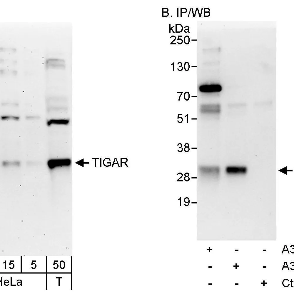 Rabbit anti-TIGAR Antibody, Affinity Purified
