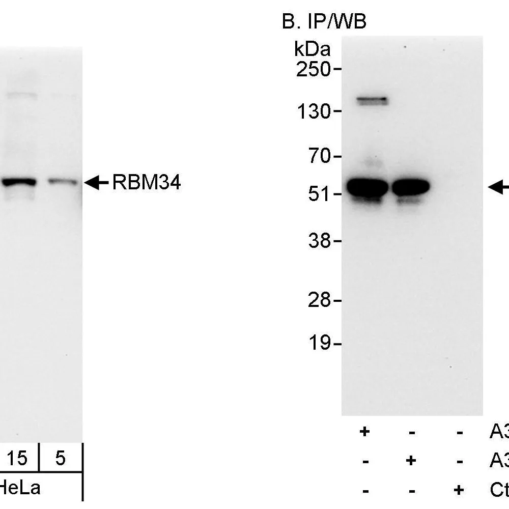 Rabbit anti-RBM34 Antibody, Affinity Purified