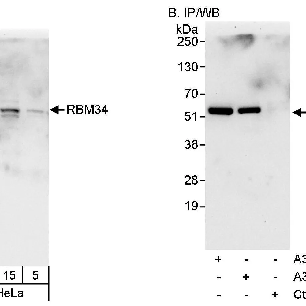 Rabbit anti-RBM34 Antibody, Affinity Purified