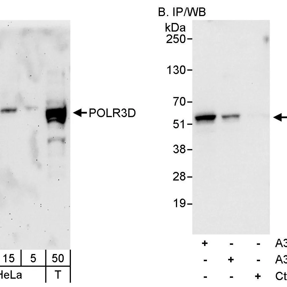 Rabbit anti-POLR3D Antibody, Affinity Purified