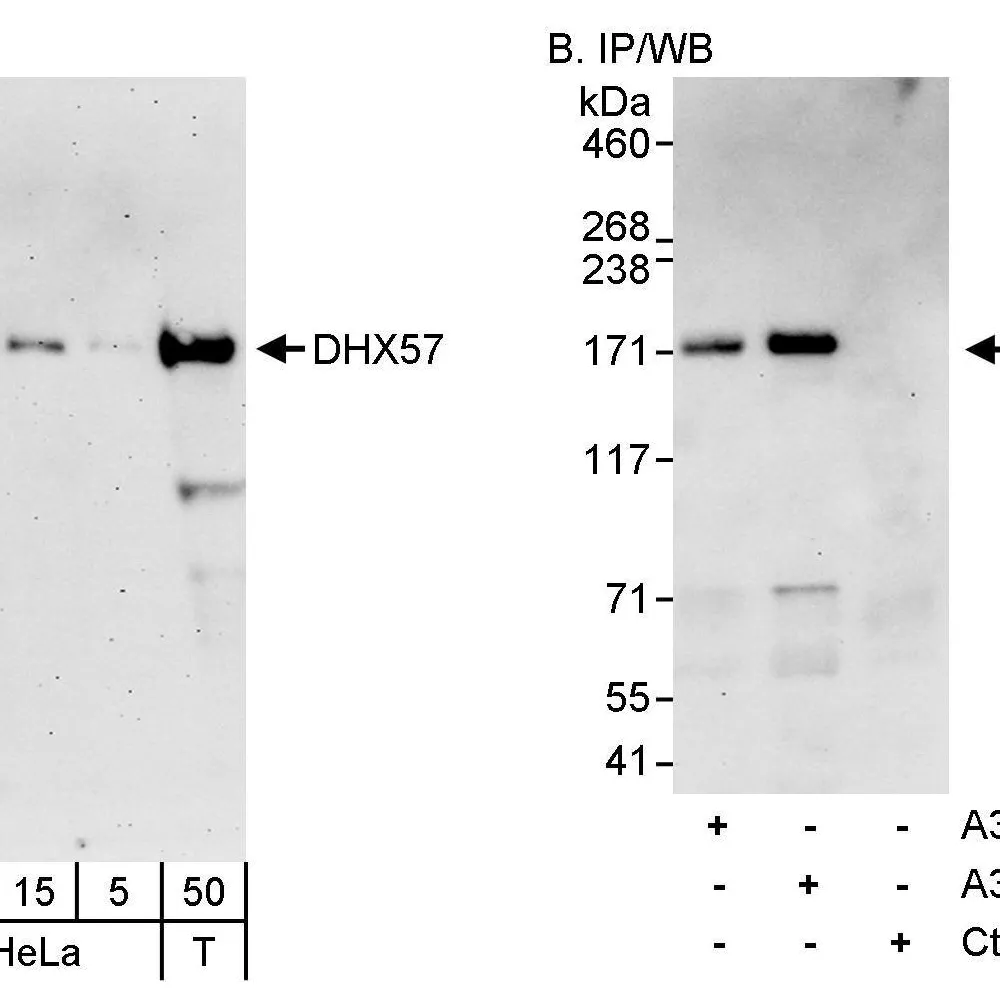 Rabbit anti-DHX57 Antibody, Affinity Purified