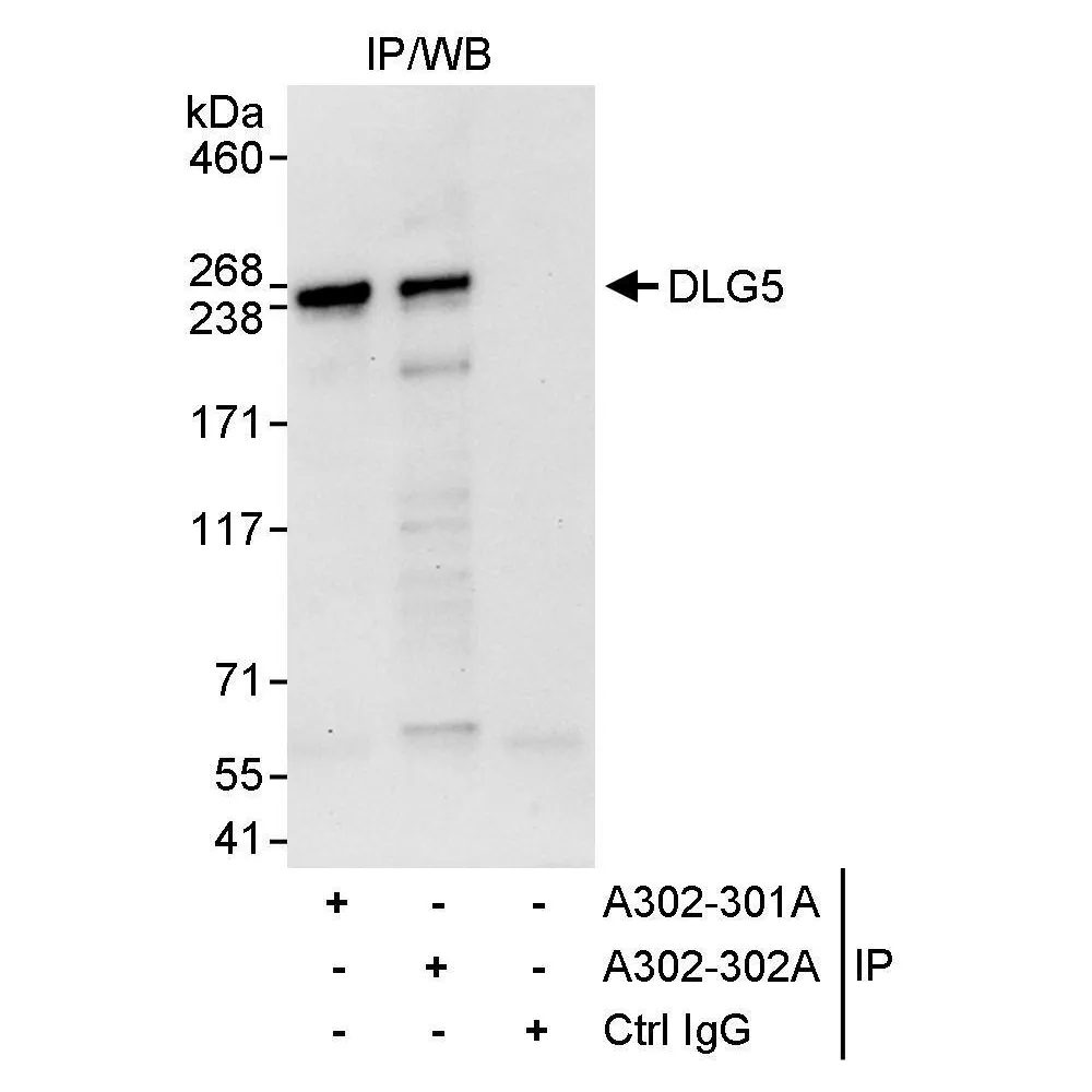 Rabbit anti-DLG5 Antibody, Affinity Purified