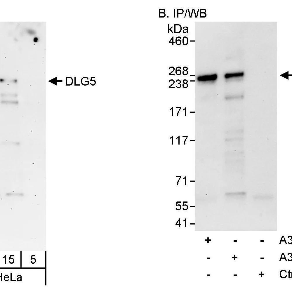 Rabbit anti-DLG5 Antibody, Affinity Purified