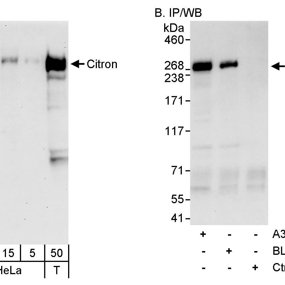 Rabbit anti-Citron Antibody, Affinity Purified