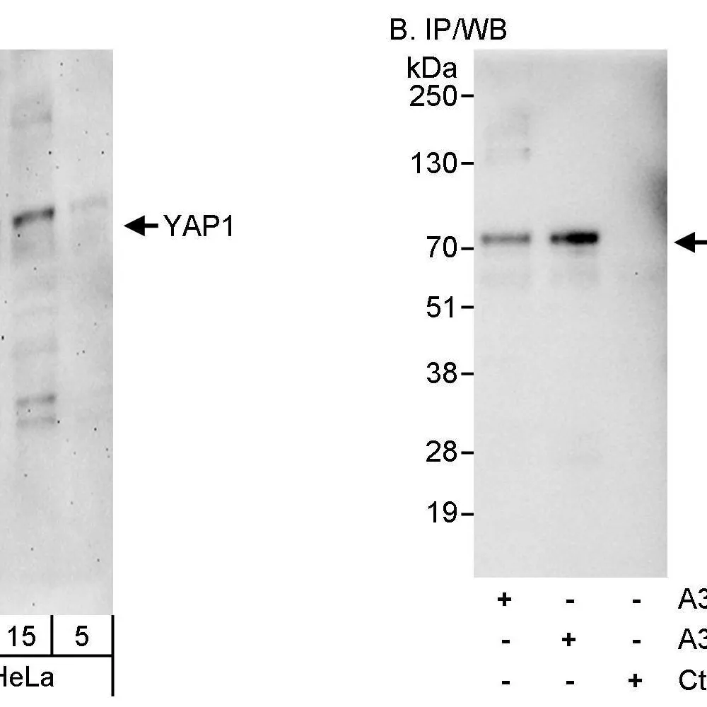 Rabbit anti-YAP1 Antibody, Affinity Purified