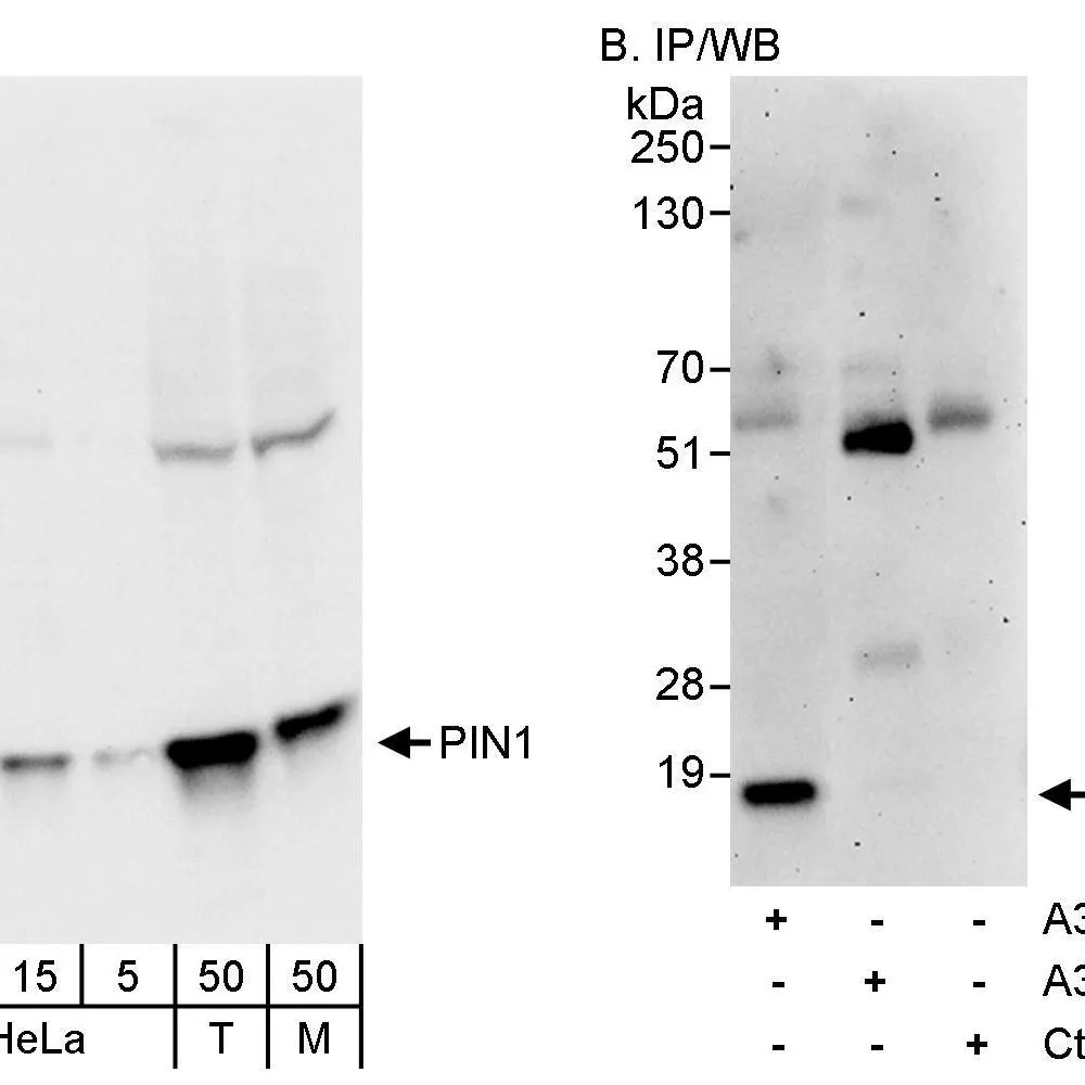 Rabbit anti-PIN1 Antibody, Affinity Purified
