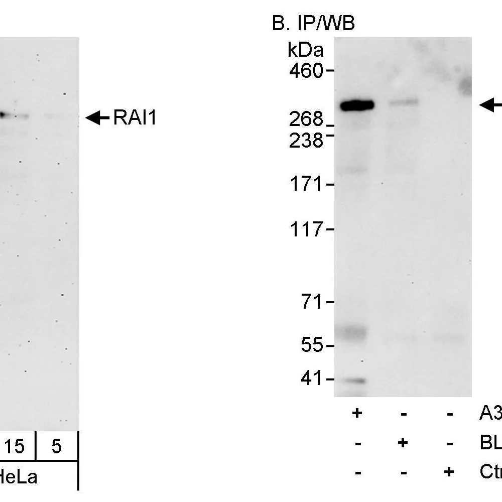 Rabbit anti-RAI1 Antibody, Affinity Purified