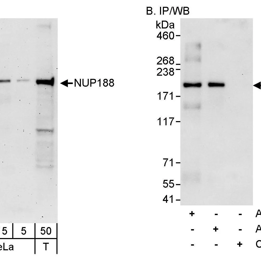 Rabbit anti-NUP188 Antibody, Affinity Purified