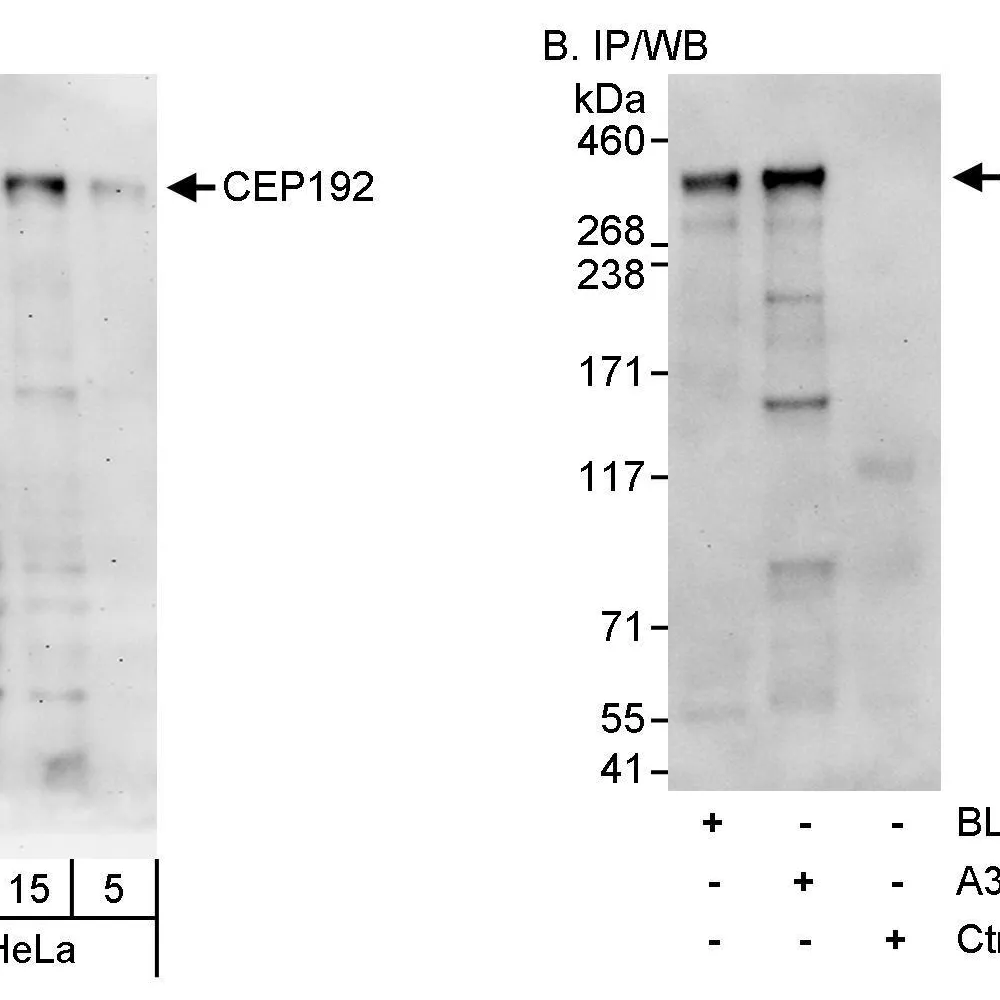 Rabbit anti-CEP192 Antibody, Affinity Purified