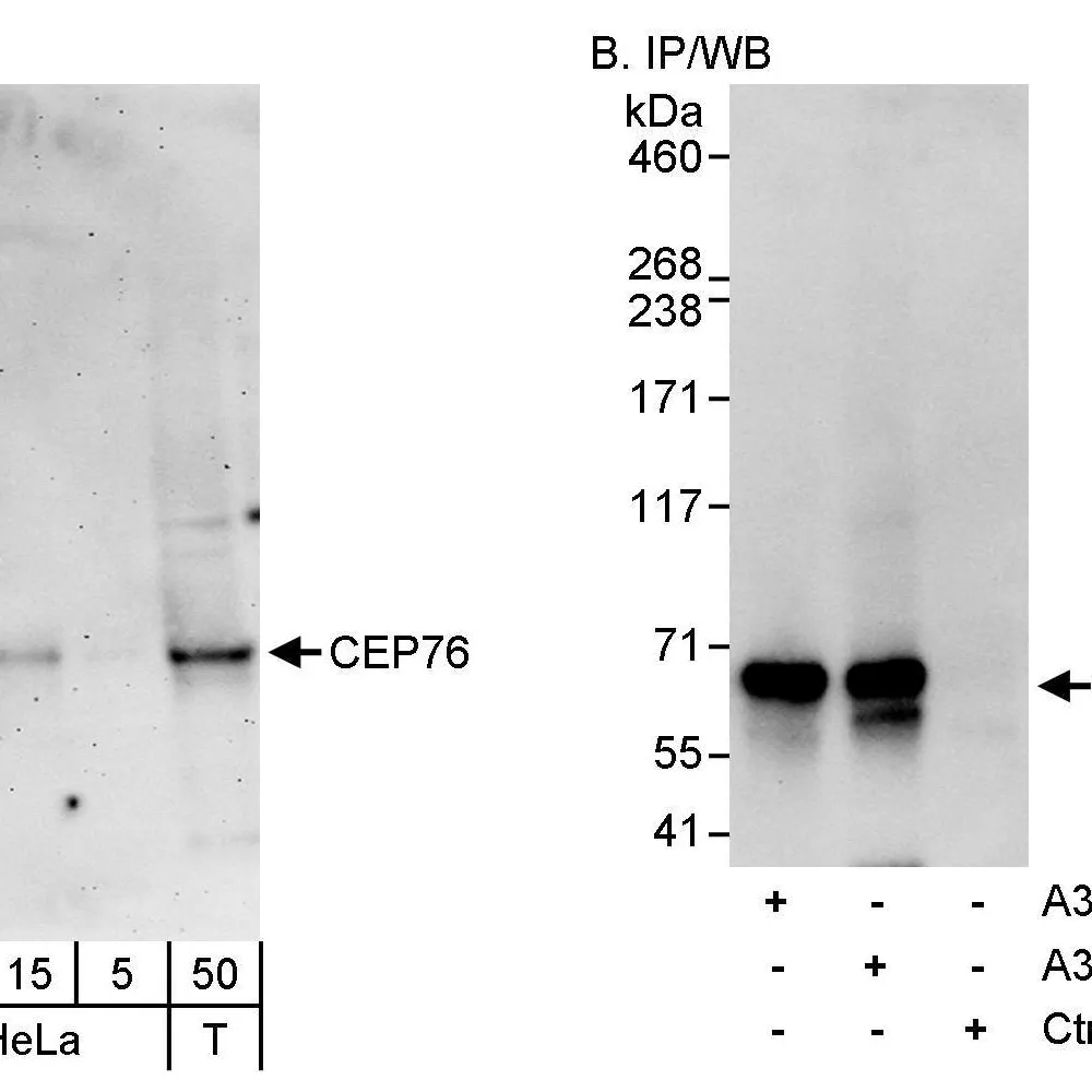 Rabbit anti-CEP76 Antibody, Affinity Purified