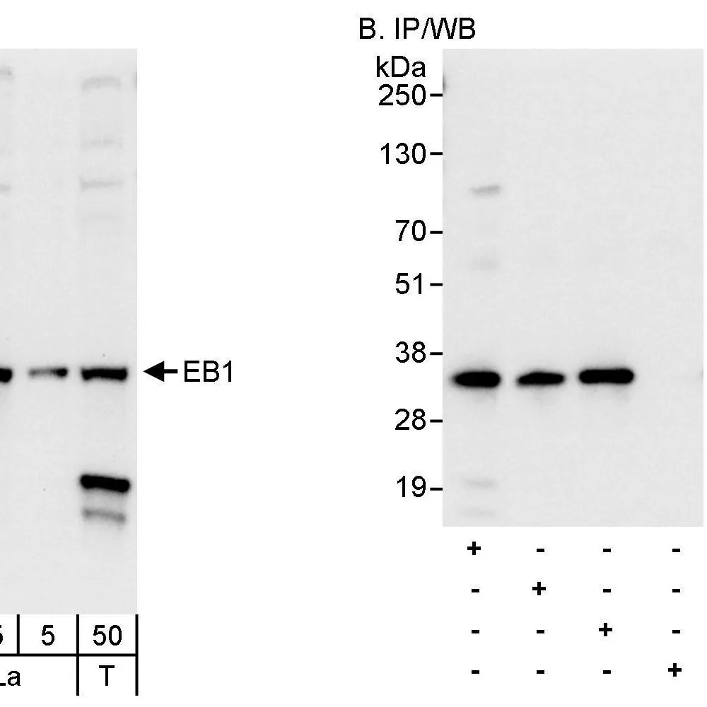 Rabbit anti-EB1 Antibody, Affinity Purified
