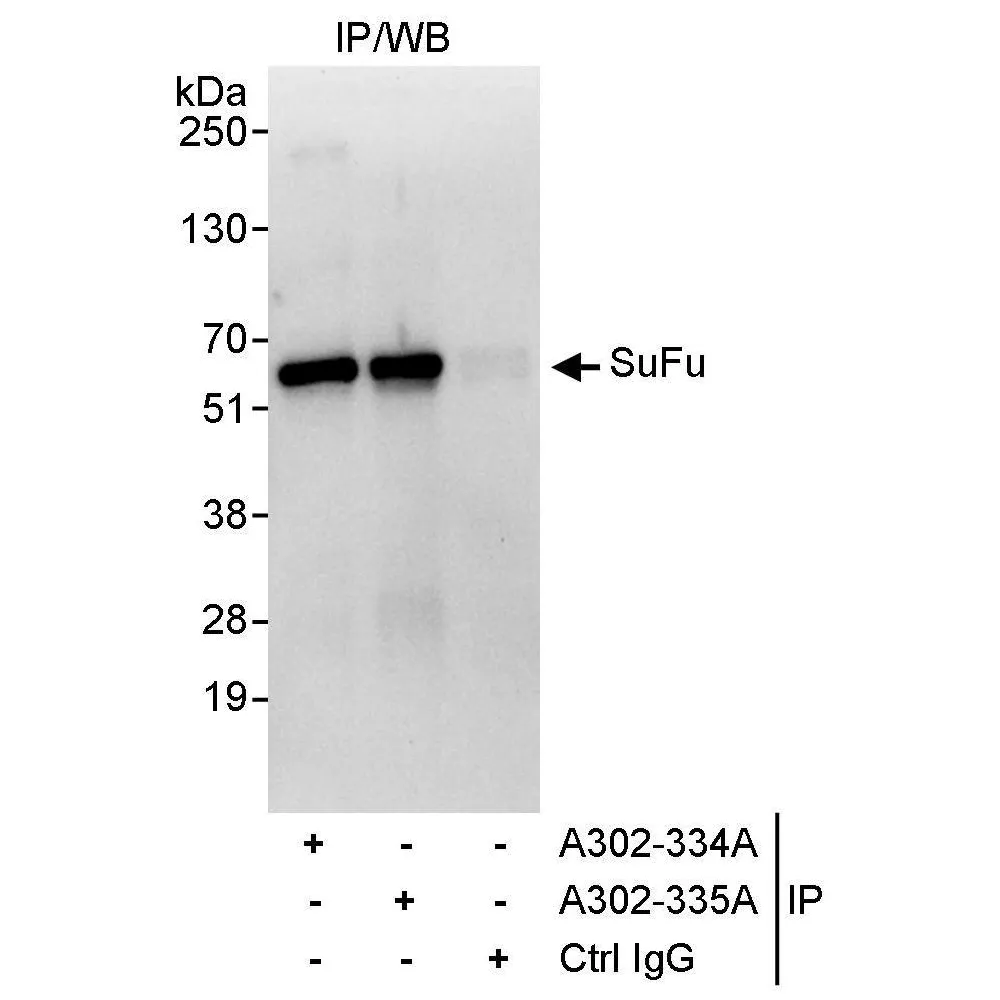 Rabbit anti-SuFu Antibody, Affinity Purified