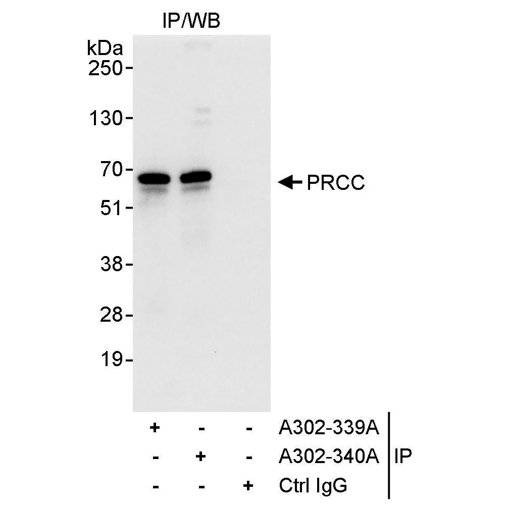 Rabbit anti-PRCC Antibody, Affinity Purified