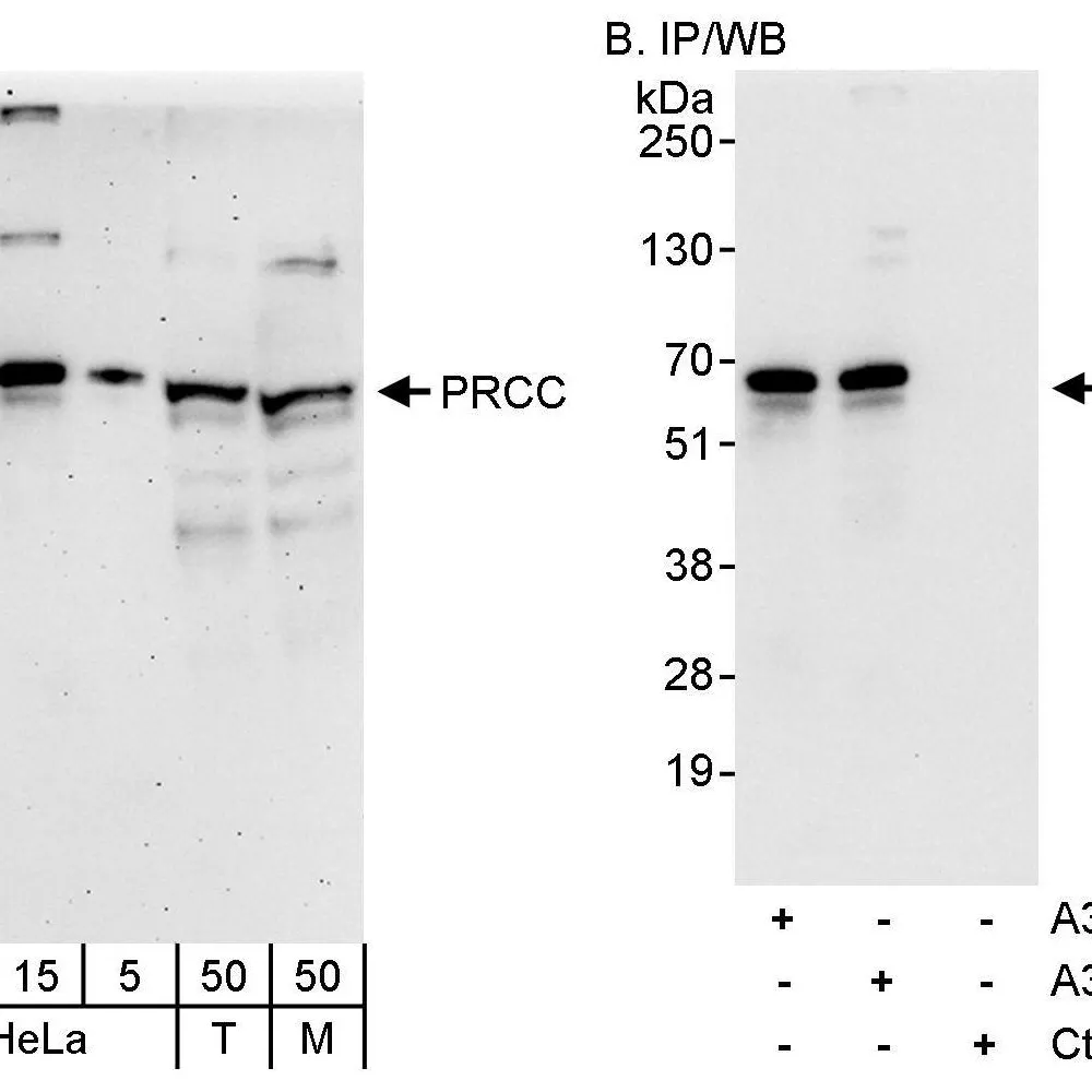 Rabbit anti-PRCC Antibody, Affinity Purified