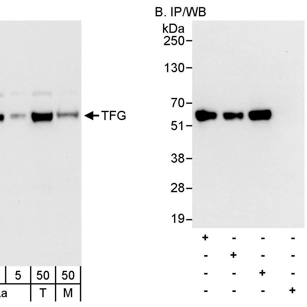 Rabbit anti-TFG Antibody, Affinity Purified