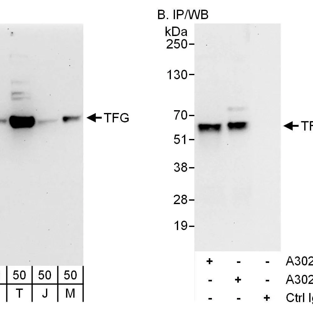 Rabbit anti-TFG Antibody, Affinity Purified