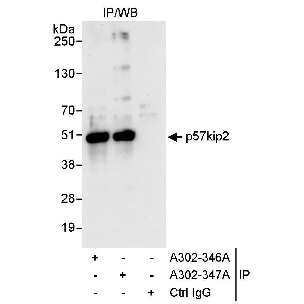 Rabbit anti-p57kip2 Antibody, Affinity Purified