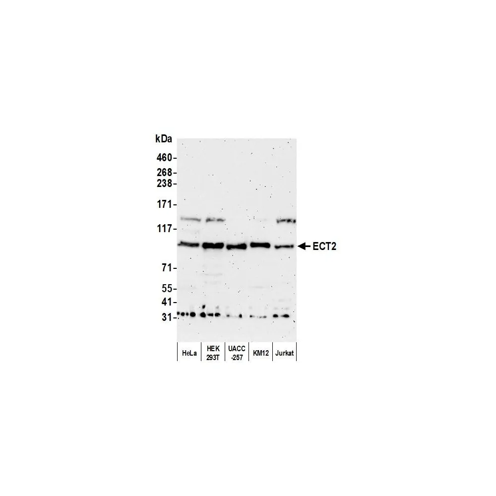 Rabbit anti-ECT2 Antibody, Affinity Purified