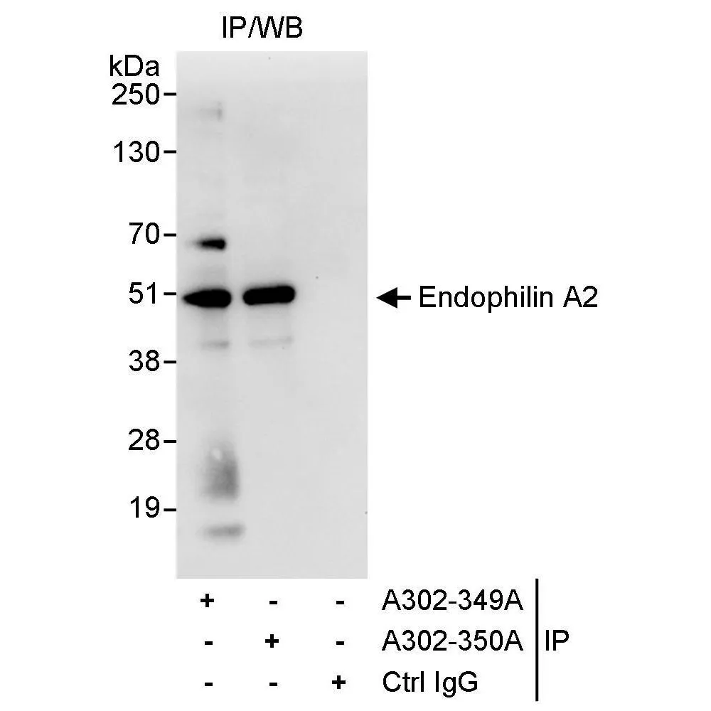 Rabbit anti-Endophilin A2 Antibody, Affinity Purified