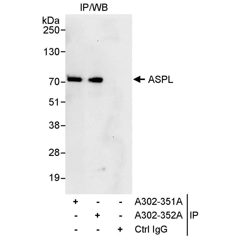 Rabbit anti-ASPL Antibody, Affinity Purified
