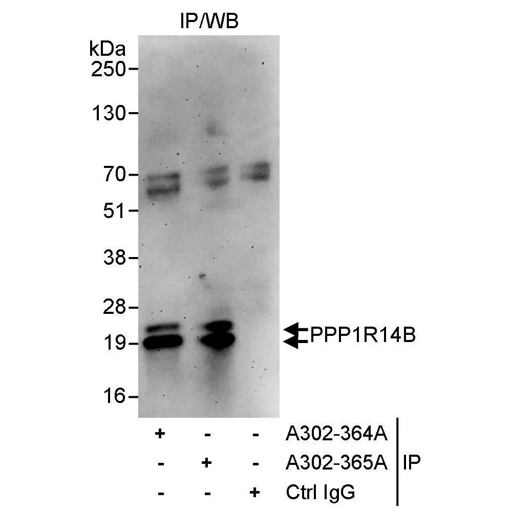Rabbit anti-PPP1R14B Antibody, Affinity Purified