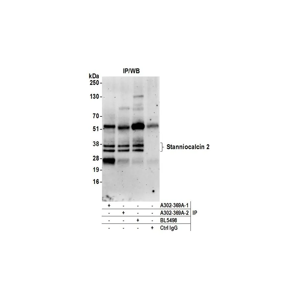 Rabbit anti-Stanniocalcin 2 Antibody, Affinity Purified