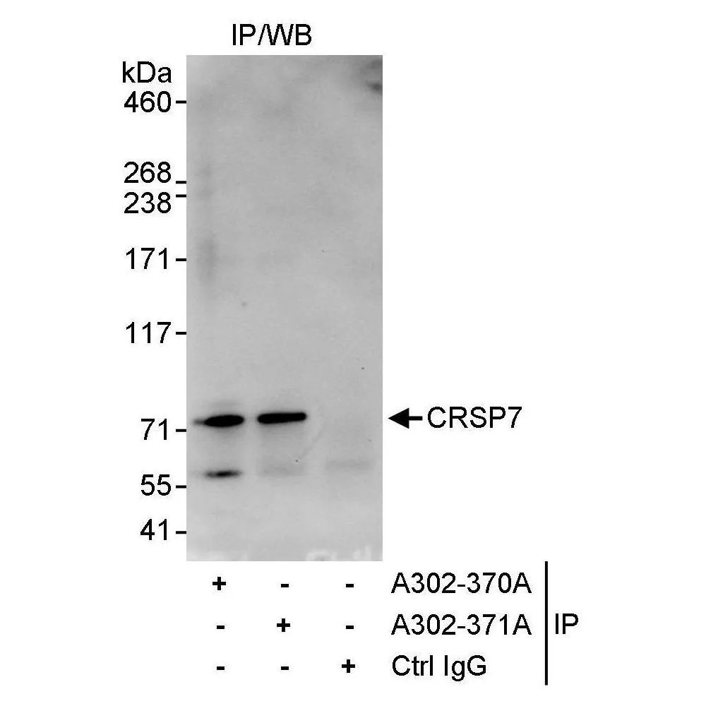 Rabbit anti-CRSP7 Antibody, Affinity Purified